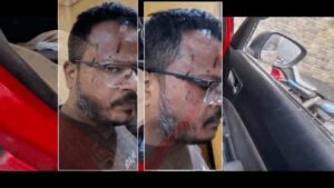 सच पर वार… शीशा टूटा, खून बहा — पर कलम झुकी नहीं